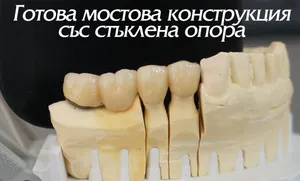 Готова стъклена опора