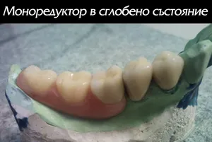 Готов моноредуктор