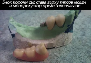 Детайл на ставата на моноредуктора
