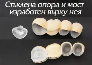 Стъклена опора с поставен върху нея мост