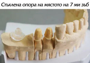 Индивидуално изработена стъклена опора ZX-27