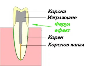 Ферул-ефект — короната обхваща здрава зъбна тъкан
