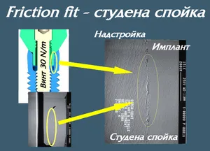 Friction Fit връзка между импланта и надстройката