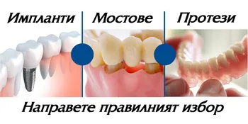 Протеза, мост и имплант — трите варианта за възстановяване на липсващ зъб