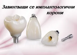 Завинтваща се корона върху имплант