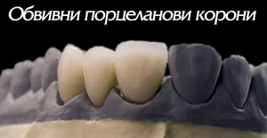 Керамична обвивна корона