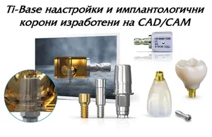 Ti-Base надстройки за безметални корони върху импланти