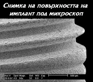 Награпавена повърхност на титаниев имплант