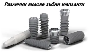 Зъбни импланти с различна резба
