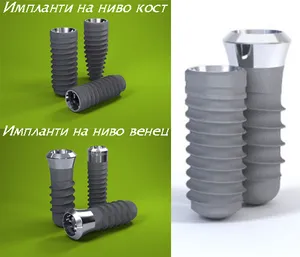 Имплант на ниво кост — връзката с надстройката е на нивото на костта