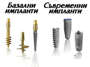 Базални и титаниеви импланти