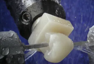 Модулът за фрезоване на CEREC изрязва порцеланова корона