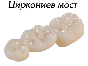 Циркониев мост