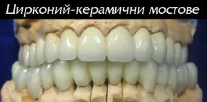 Цирконий-керамична конструкция