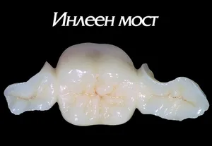 Инлеен порцеланов мост