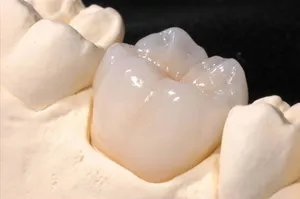 Готова металокерамична корона