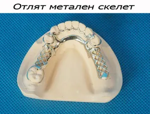 Метален скелет на моделно лята протеза