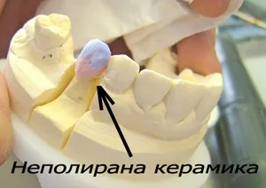 Проба на металокерамична корона