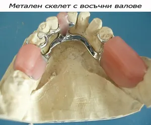 Проба на метален скелет и шаблон в устата