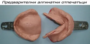 Предварителен отпечатък на челюстта с алгинат