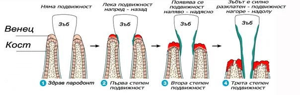 Схема на трите степени на подвижност на зъбите