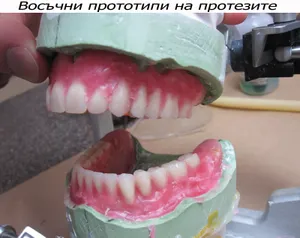 Проба на протеза с наредени зъби