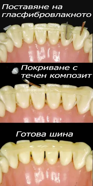 Шина от гласфибровлакна и композит откъм езика