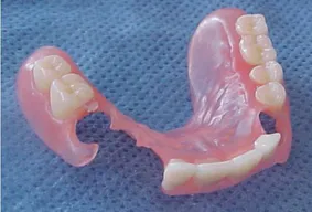 Частична силиконова протеза от Valplast