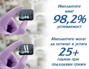Успеваемост на имплантологичното лечение в сравнение с други лечения